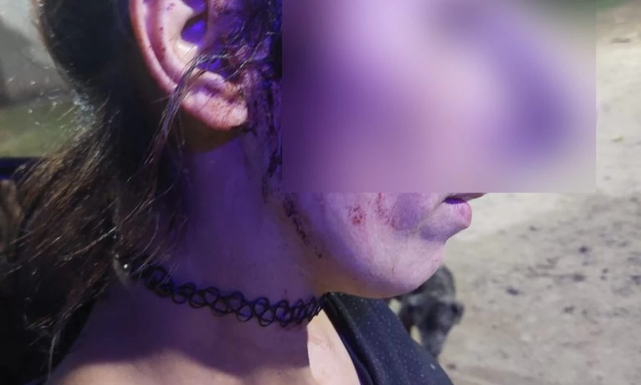 Violencia de Género: Un hombre atacó por segunda vez a su ex pareja