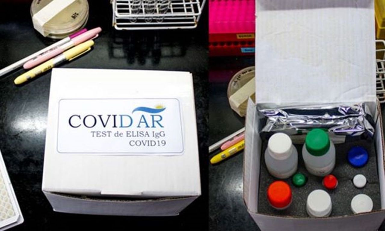 El primer test serológico del país para el coronavirus